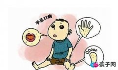 什么是手足口病?手足口病怎么治疗 什么是手足口病?手足口病怎么治疗
