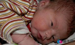 初生婴儿的五个奇怪状况 初生婴儿的五个奇怪状况