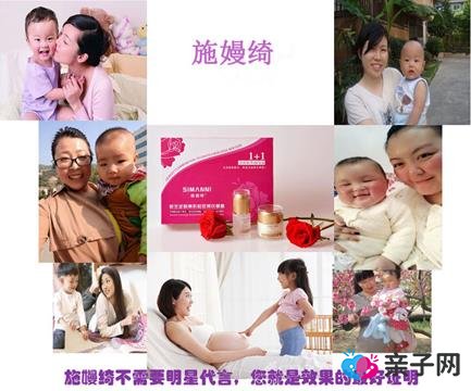 多年的妊娠纹怎么去除 去除妊娠纹用什么好