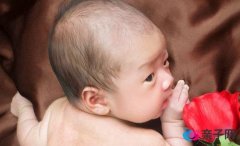 新生儿黄疸的预防护理 新生儿黄疸的预防护理