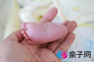 剖腹产和顺产哪个容易羊栓 剖腹产和顺产哪个容易羊栓