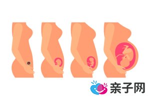 第一次做流产可以药流吗